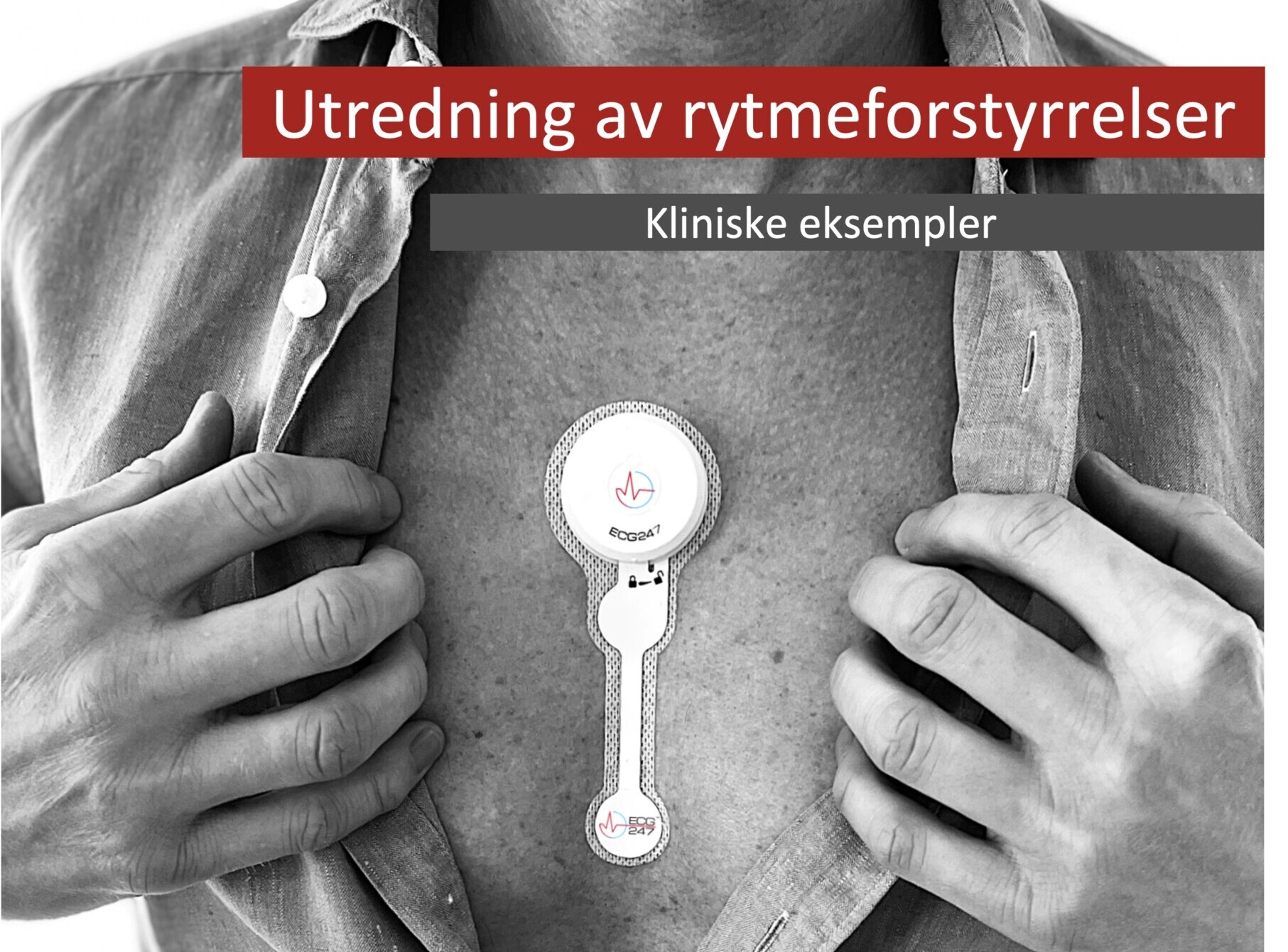 Kliniske eksempler