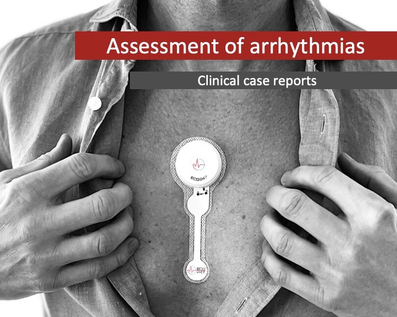 ECG247 Clinical case reports